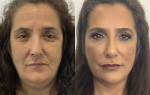 Mudança de Visual | Maria de Fátima