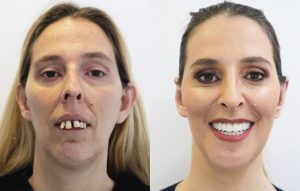 Mudança de Visual | Alexandra Bettencourt